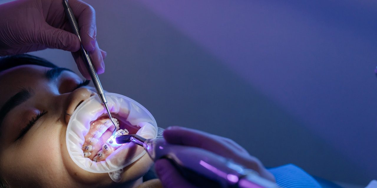 Co to są implanty i jakie są ich najważniejsze zalety?