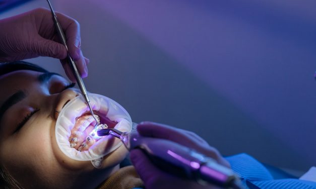 Co to są implanty i jakie są ich najważniejsze zalety?