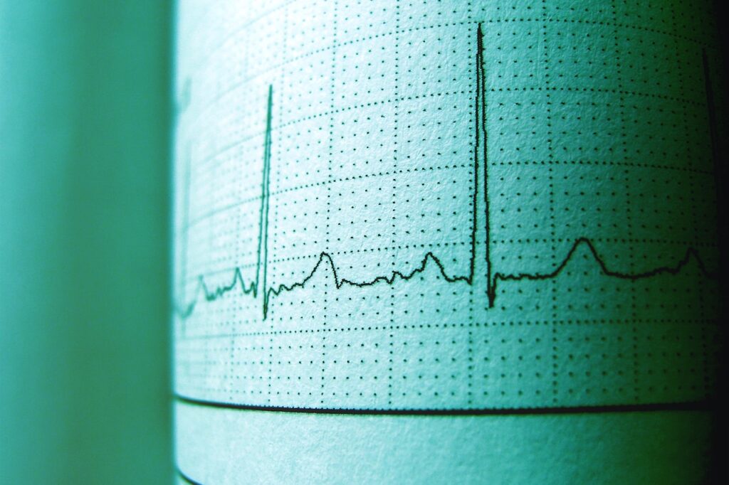 badanie ekg