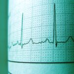 Jak przebiega badanie EKG?