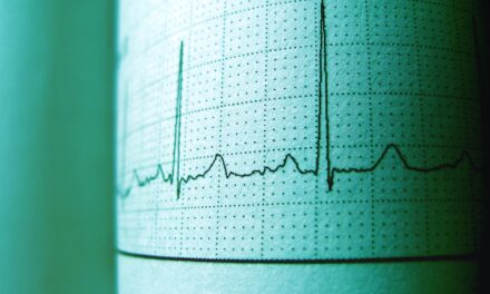 Jak przebiega badanie EKG?