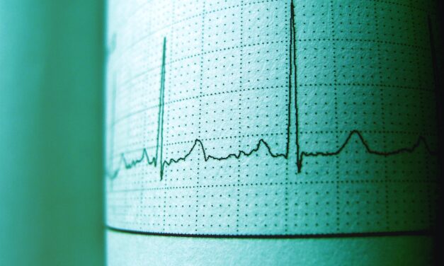 Jak przebiega badanie EKG?