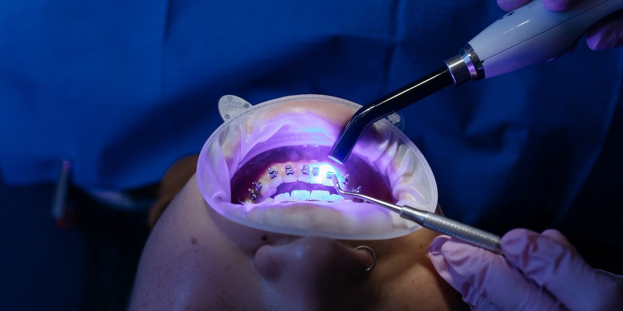 Kiedy warto pójść do ortodonty?