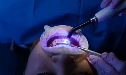 Kiedy warto pójść do ortodonty?