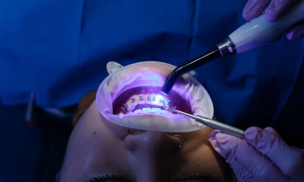 Kiedy warto pójść do ortodonty?